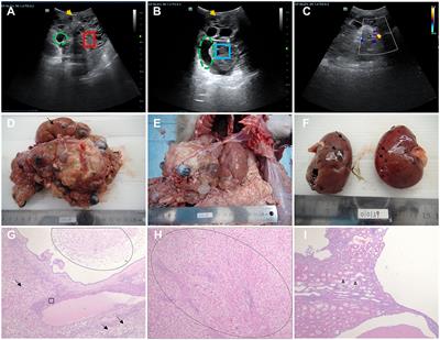 Phenotypes and genetic etiology of spontaneous polycystic kidney and liver disease in cynomolgus monkey